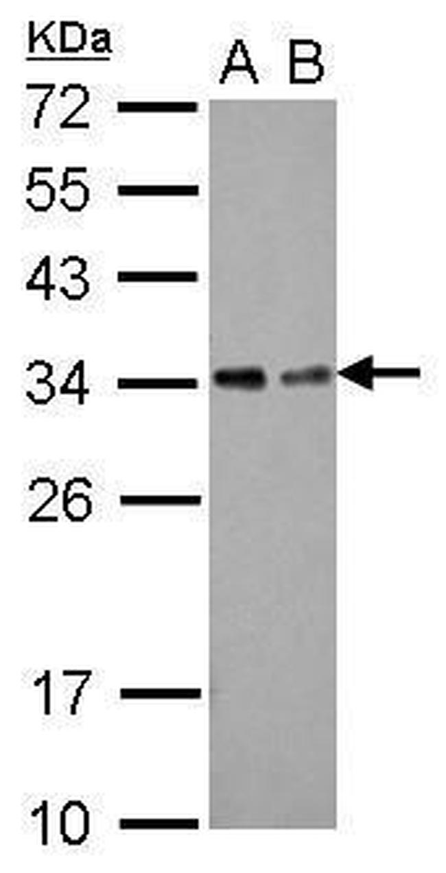 TOLLIP Antibody in Western Blot (WB)