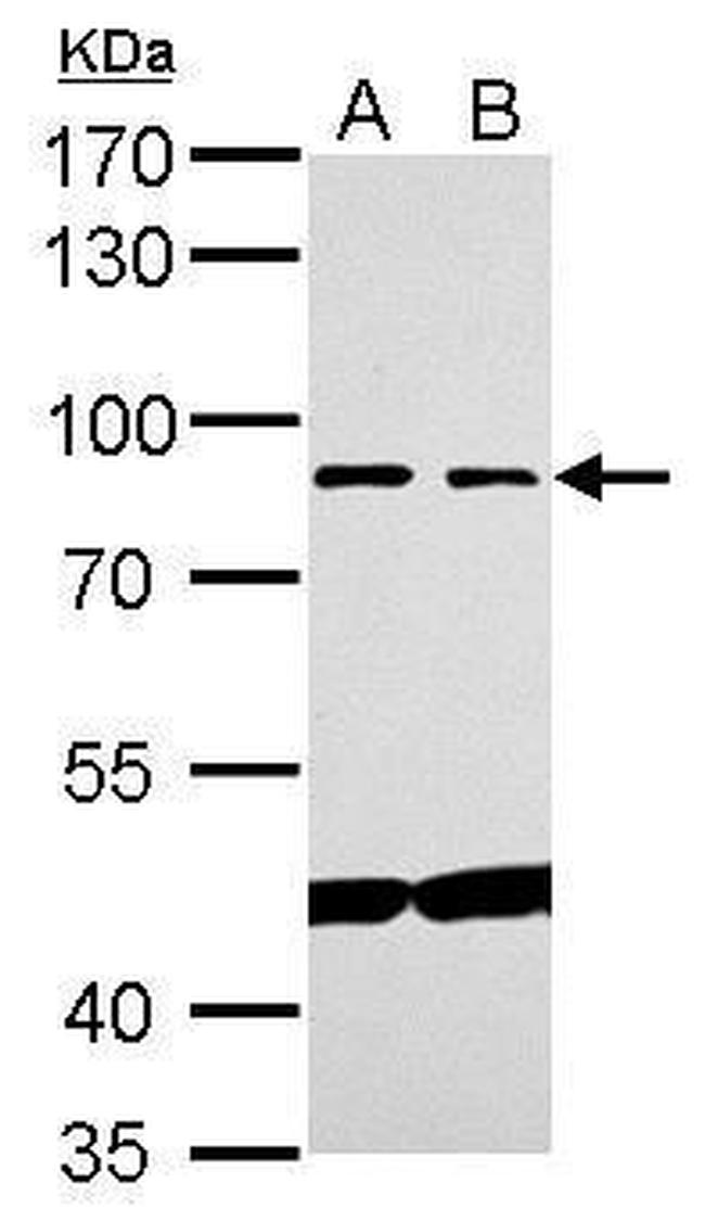 MRE11 Antibody in Western Blot (WB)