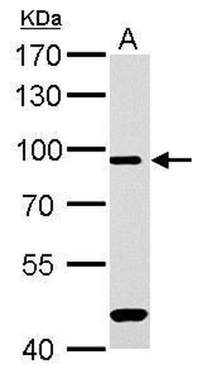 MRE11 Antibody in Western Blot (WB)