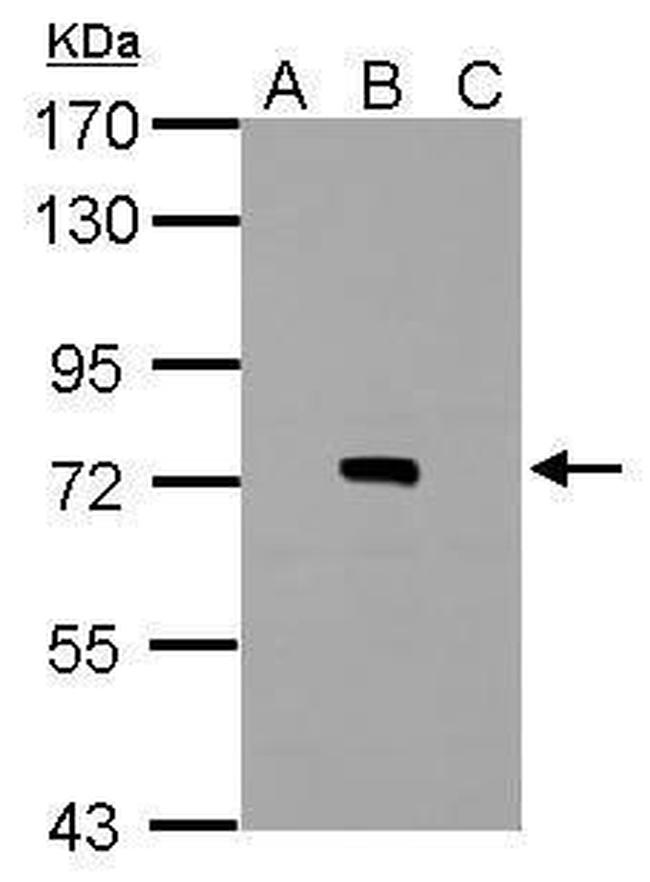 Dengue Virus Type 2 NS3 Antibody in Western Blot (WB)