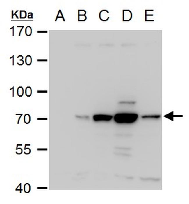 Dengue Virus Type 2 NS3 Antibody in Western Blot (WB)