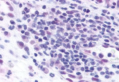 CCR3 Antibody in Immunohistochemistry (Paraffin) (IHC (P))