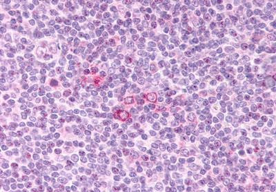 CCR3 Antibody in Immunohistochemistry (Paraffin) (IHC (P))