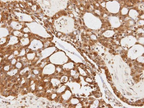 14-3-3 sigma Antibody in Immunohistochemistry (Paraffin) (IHC (P))