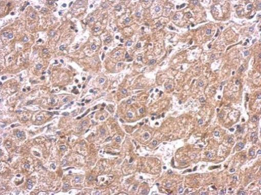 mTOR Antibody in Immunohistochemistry (Paraffin) (IHC (P))