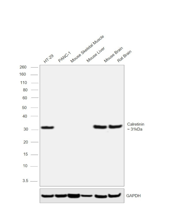 Calretinin Antibody