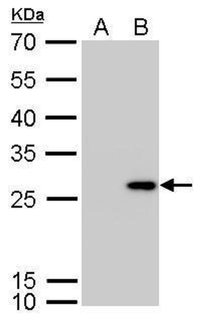 Calretinin Antibody in Western Blot (WB)