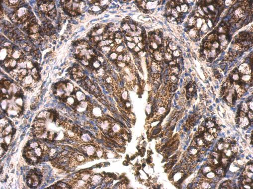 HSP60 Antibody in Immunohistochemistry (Paraffin) (IHC (P))