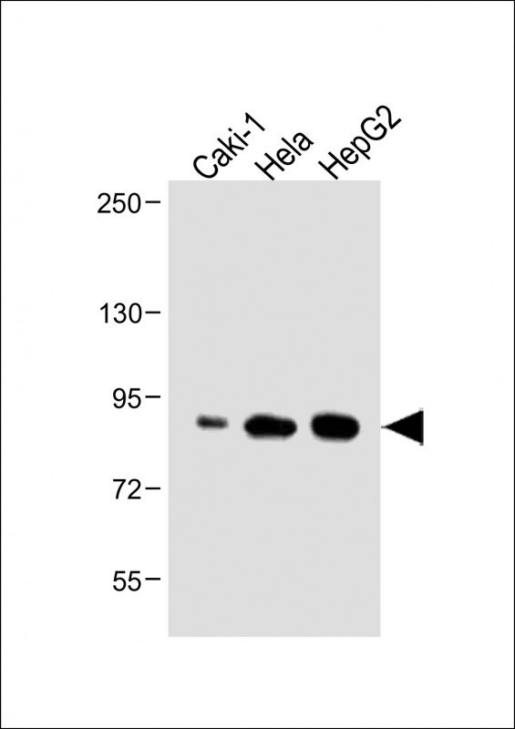 ATG7 Antibody in Western Blot (WB)