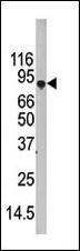 ATG7 Antibody in Western Blot (WB)