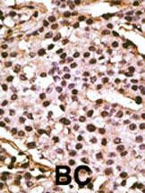 ATG9A Antibody in Immunohistochemistry (Paraffin) (IHC (P))