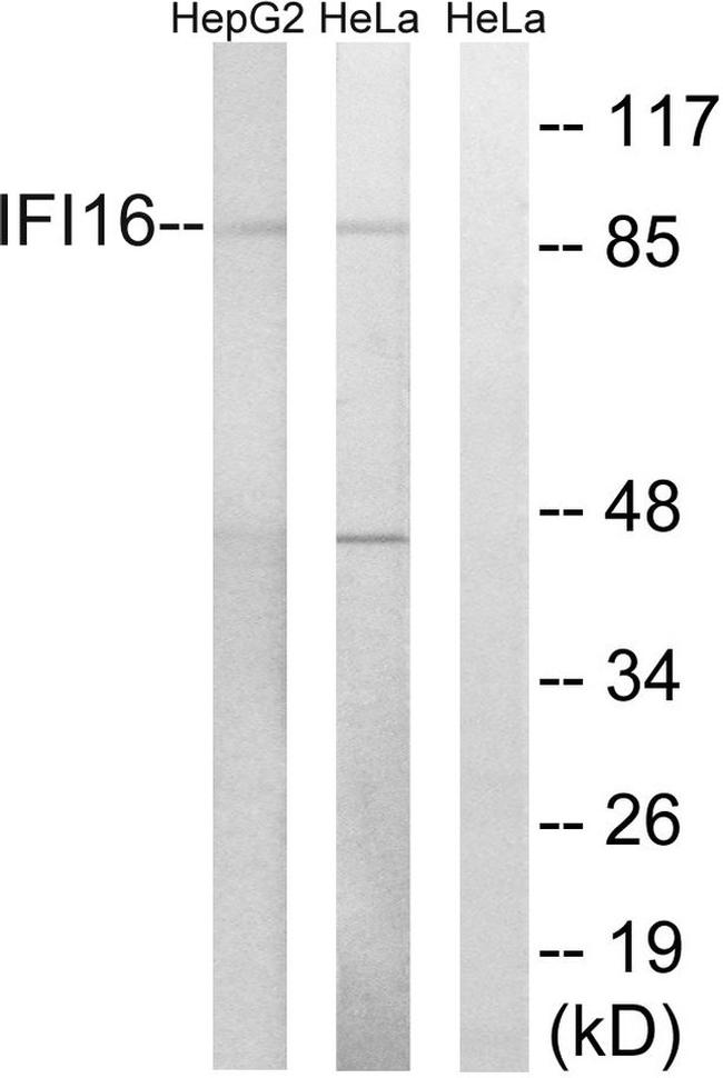 IFI16 Antibody in Western Blot (WB)