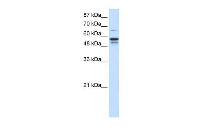 FOXG1 Antibody in Western Blot (WB)