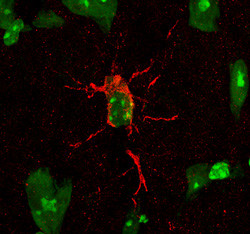 CD10 Antibody in Immunohistochemistry (Frozen) (IHC (F))