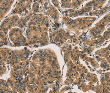 ICAT Antibody in Immunohistochemistry (Paraffin) (IHC (P))