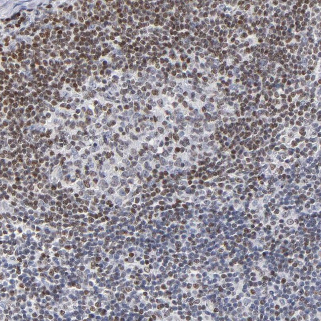 IFI16 Antibody in Immunohistochemistry (IHC)