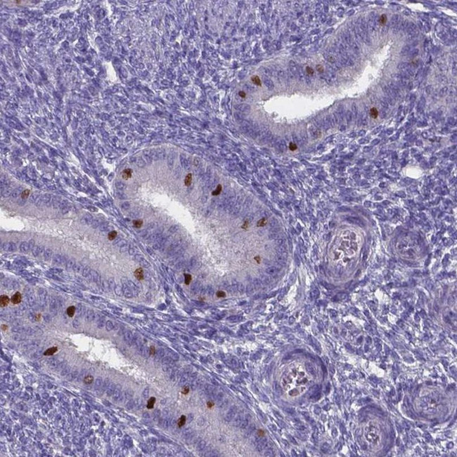 FOXJ1 Antibody in Immunohistochemistry (IHC)