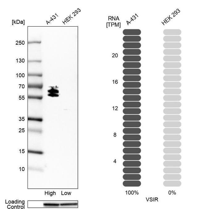 VISTA Antibody in Western Blot (WB)