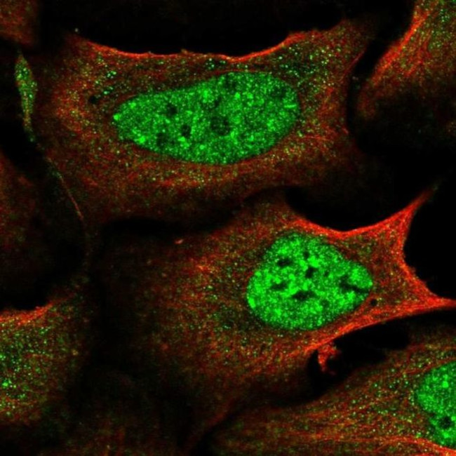 IKZF4 Antibody in Immunocytochemistry (ICC/IF)