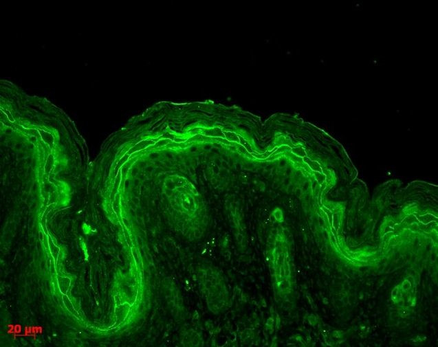 ERK1 Antibody in Immunohistochemistry (PFA fixed) (IHC (PFA))