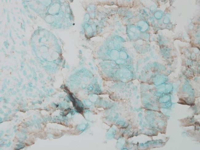 ERK1 Antibody in Immunohistochemistry (Paraffin) (IHC (P))