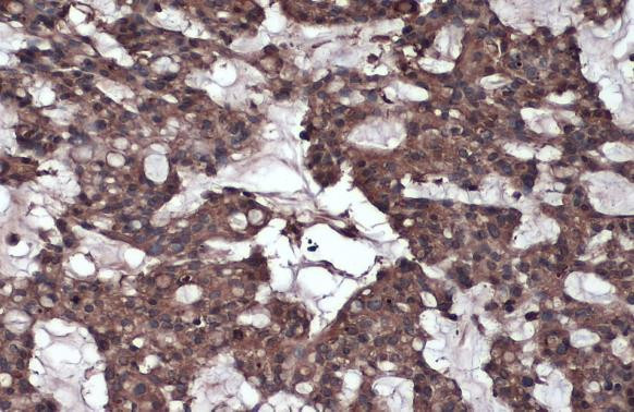 Caspase 8 Antibody in Immunohistochemistry (Paraffin) (IHC (P))