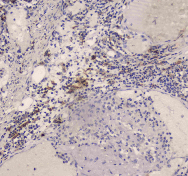 DC-SIGN (CD209) Antibody in Immunohistochemistry (Paraffin) (IHC (P))