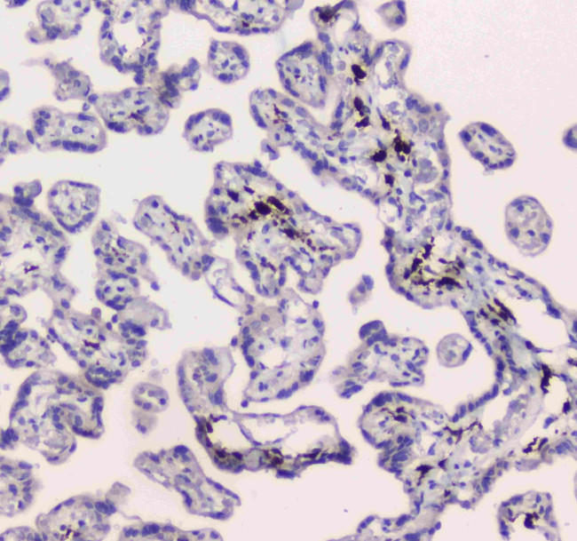 DC-SIGN (CD209) Antibody in Immunohistochemistry (Paraffin) (IHC (P))