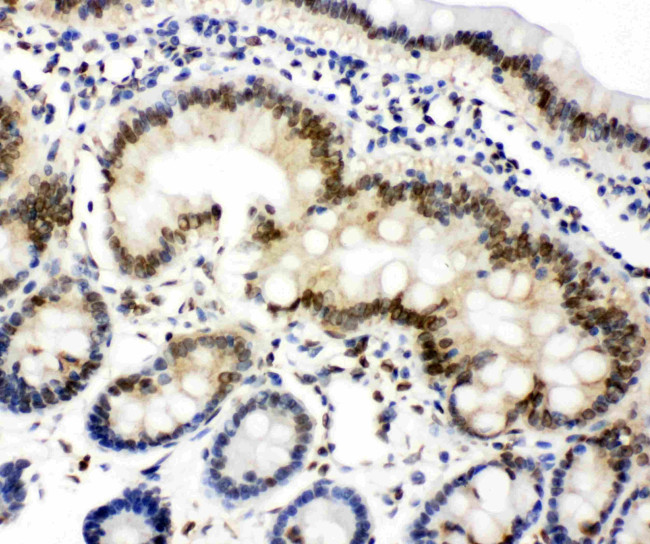 Lamin A/C Antibody in Immunohistochemistry (Paraffin) (IHC (P))