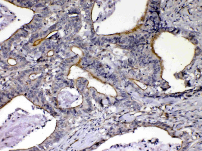 NOV Antibody in Immunohistochemistry (Paraffin) (IHC (P))