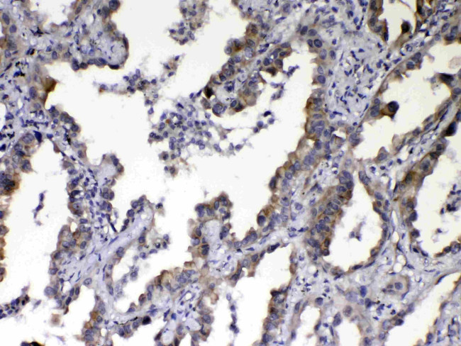 NOV Antibody in Immunohistochemistry (Paraffin) (IHC (P))