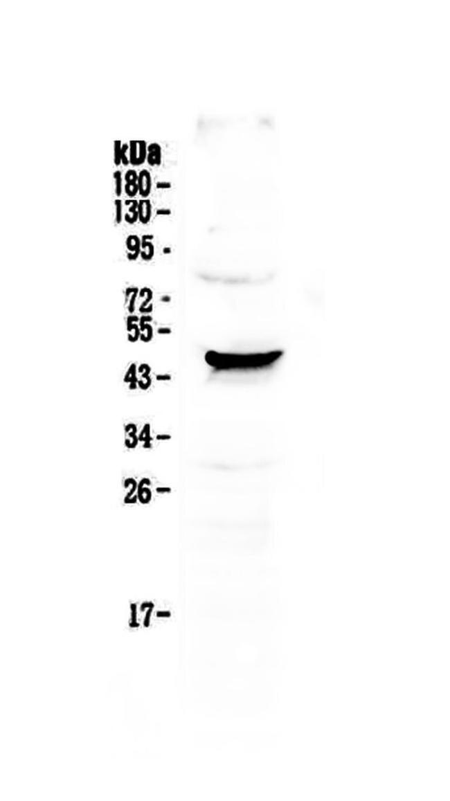 NOV Antibody in Western Blot (WB)