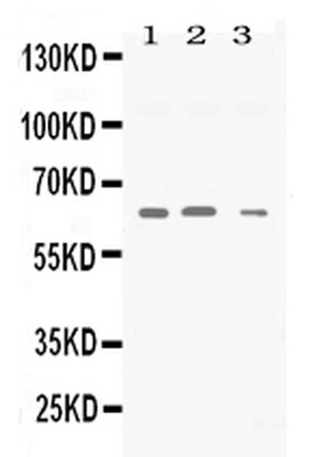 Synapsin II Antibody in Western Blot (WB)