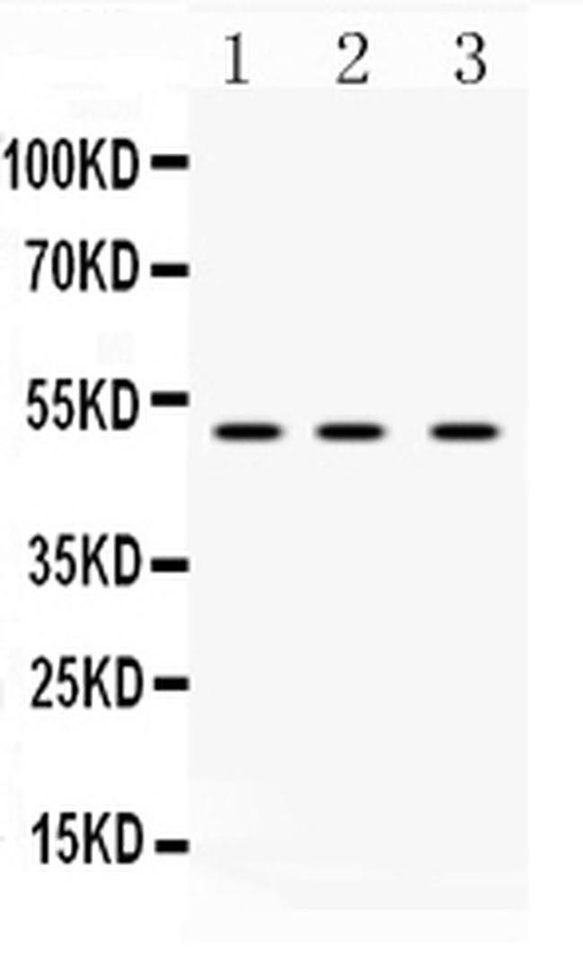 DR4 Antibody in Western Blot (WB)