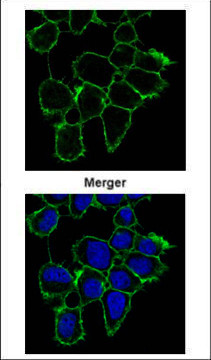 EGFR Antibody in Immunocytochemistry (ICC/IF)