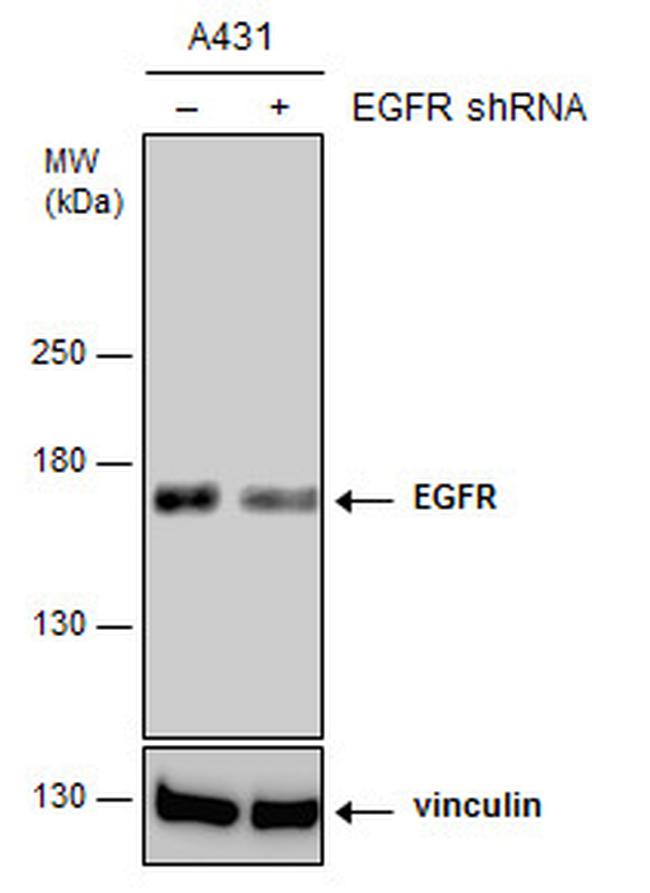 EGFR Antibody in Western Blot (WB)