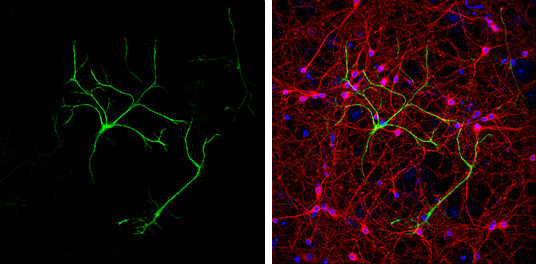 GFAP Antibody in Immunocytochemistry (ICC/IF)