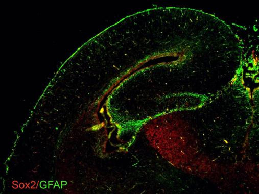 GFAP Antibody in Immunohistochemistry (Frozen) (IHC (F))