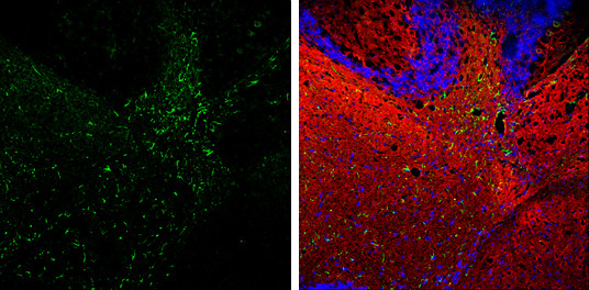 GFAP Antibody in Immunohistochemistry (Frozen) (IHC (F))