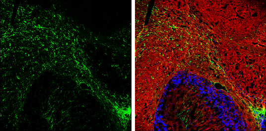 GFAP Antibody in Immunohistochemistry (Frozen) (IHC (F))