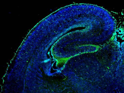 GFAP Antibody in Immunohistochemistry (Frozen) (IHC (F))