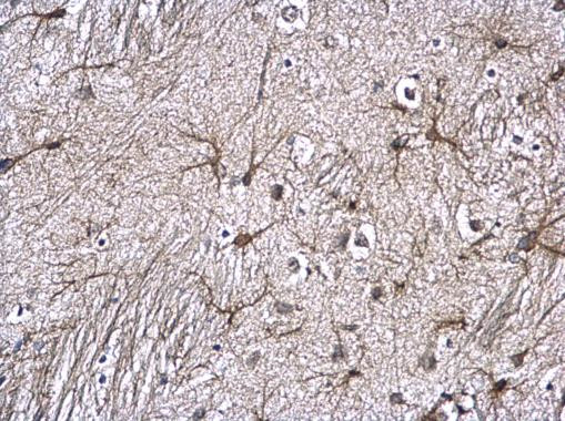 GFAP Antibody in Immunohistochemistry (Paraffin) (IHC (P))