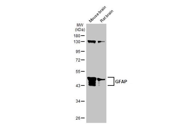 GFAP Antibody in Western Blot (WB)