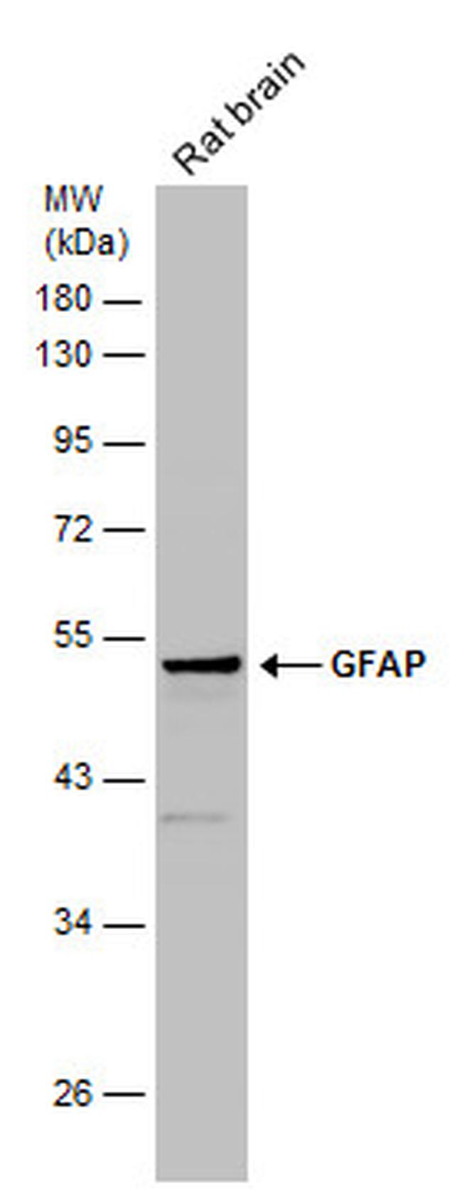 GFAP Antibody in Western Blot (WB)