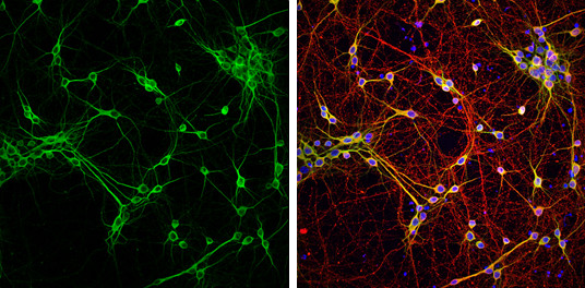 MAP2 Antibody in Immunocytochemistry (ICC/IF)