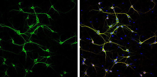 MAP2 Antibody in Immunocytochemistry (ICC/IF)