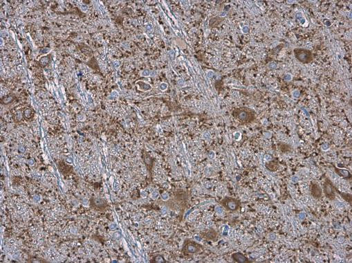 MAP2 Antibody in Immunohistochemistry (Paraffin) (IHC (P))