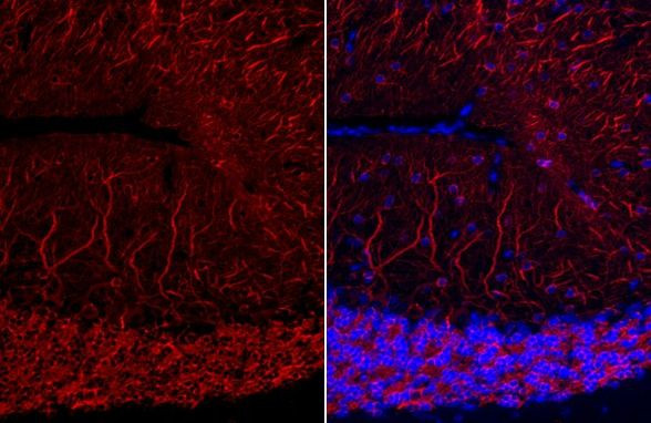 MAP2 Antibody in Immunohistochemistry (Paraffin) (IHC (P))