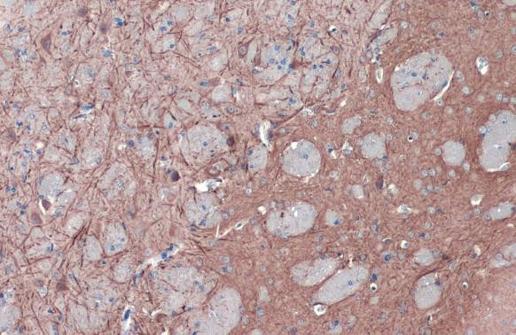 MAP2 Antibody in Immunohistochemistry (Paraffin) (IHC (P))