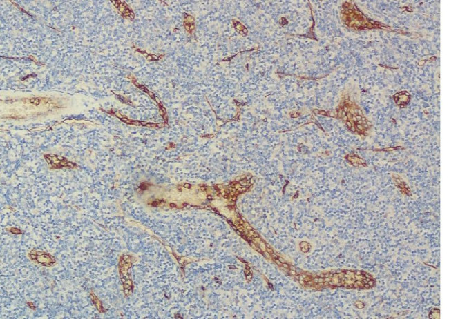 CD34 Antibody in Immunohistochemistry (Paraffin) (IHC (P))